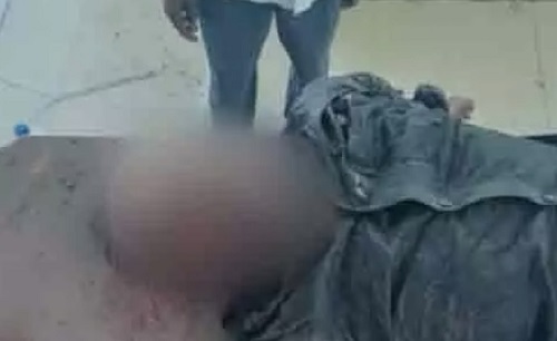 सड़क किनारे मिले घायल युवक की इलाज के दौरान हुई मौत