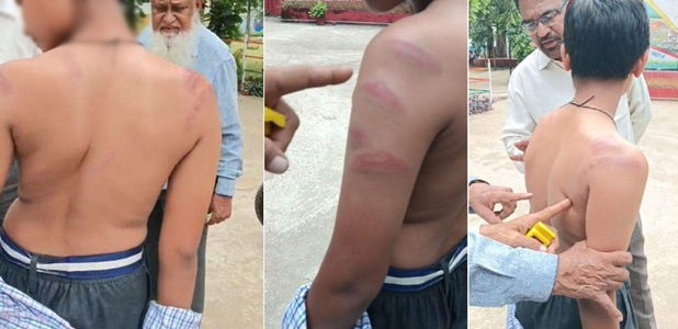 टीचर ने छात्र को डंडे से पीटा, नोट्स न लिखने पर दिया गहरा जख्म