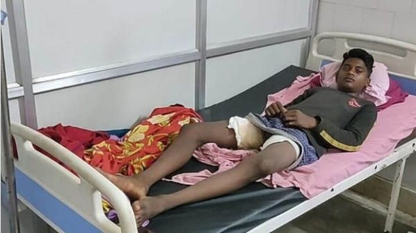  14 साल के नाबालिग बच्चे के ऊपर पेट्रोल डालकर लगाई आग