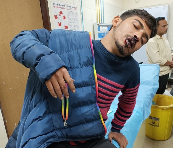 थाने से शिकायत कर लौटने पर जानलेवा हमला... मोहल्ले में खौफ...