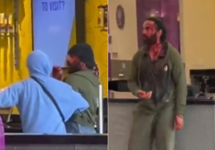 पंजाबी कलाकार अमन धालीवाल पर जानलेवा हमला, खुद ही हमलावर को पकड़ा...