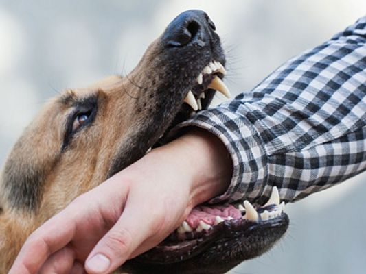 पालतू कुत्ते ने पड़ोसी को काटा, मालिक पर जुर्म दर्ज