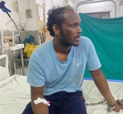 केंद्रीय जेल में बंदी पर हुआ जानलेवा हमला, अस्पताल में भर्ती...