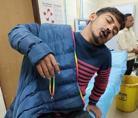 थाने से शिकायत कर लौटने पर जानलेवा हमला... मोहल्ले में खौफ...